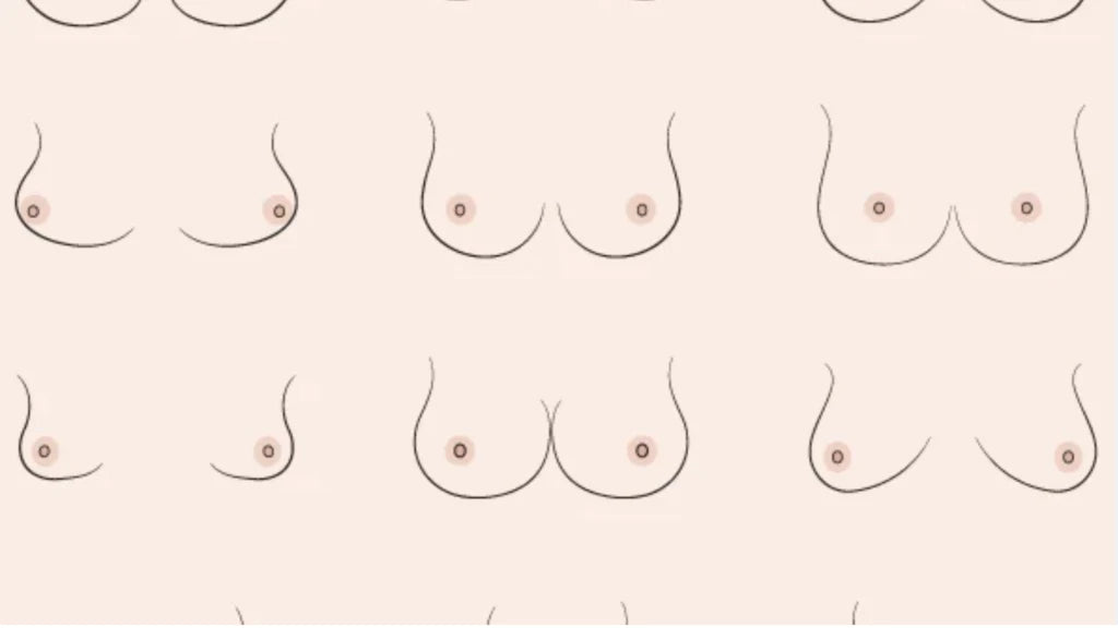 Blog 5: Debunking Myths About 'Perfect' Breasts and Beauty Standards